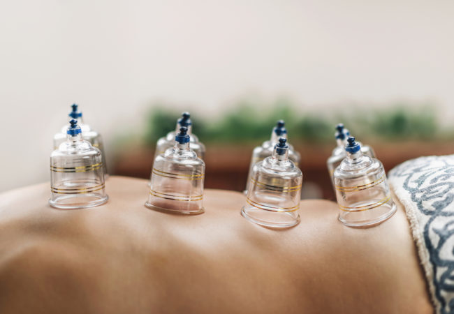 Masaje con ventosas: beneficios, contraindicaciones y mucho más