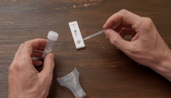 ¿Qué es el test de antígenos?