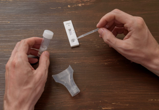 ¿Qué es el test de antígenos?